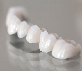 Braces