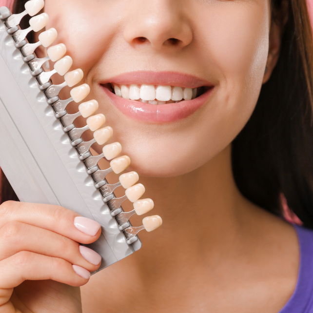 Cost of Veneers