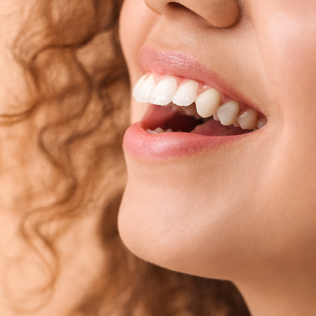 Teeth Whitening Aftercare