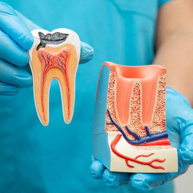 Root Canal Medisave - featured image