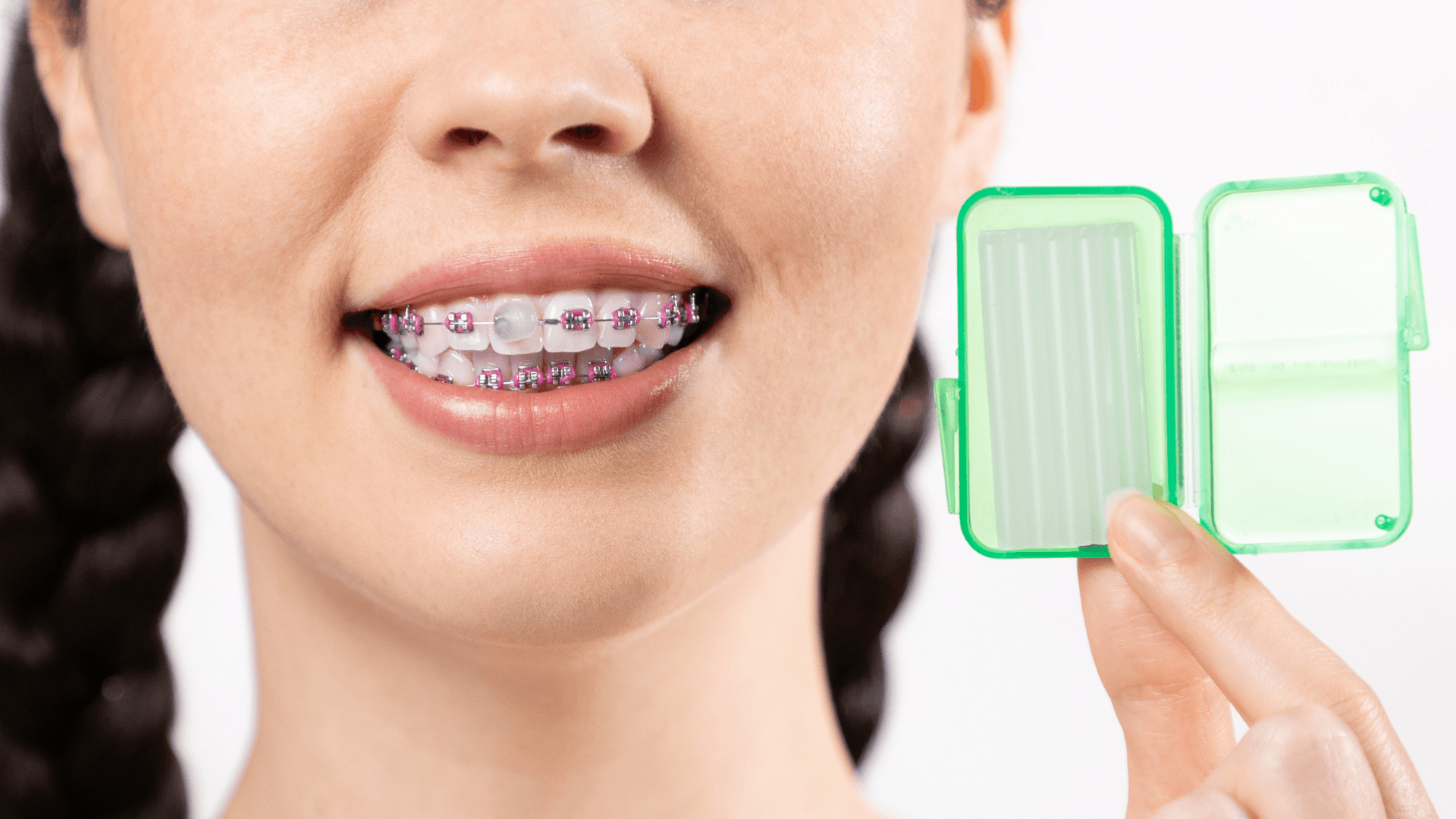 orthodontic wax
