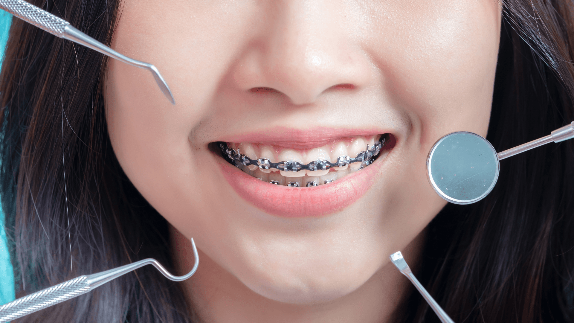Orthodontic treatment
